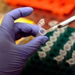 Cancro alla prostata, Dna potrebbe svelare rischio basso o alto: lo studio Cancro alla prostata, Dna potrebbe svelare rischio basso o alto: lo studio
