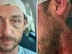 "Io aggredito a sassate in Sardegna da 30 persone perché gay", la denuncia sui social "Io aggredito a sassate in Sardegna da 30 persone perché gay", la denuncia sui social 
